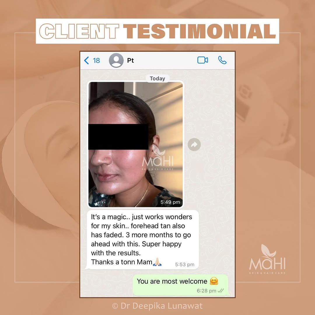 Patient testimonial pigmentation treatment Mahi Skin Clinic Chennai